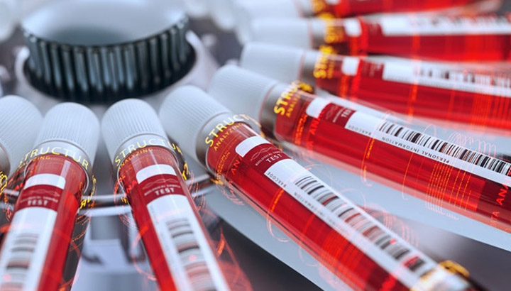 제약 산업에서의 원심 분리 적용